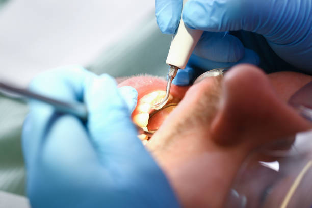 Best Emergency Orthodontic Services in Toluca, IL