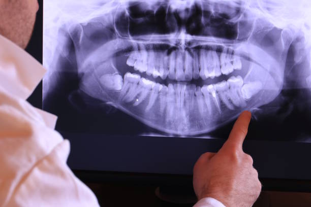 Best Emergency Gum Treatment in Toluca, IL