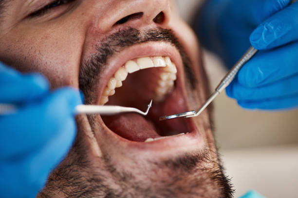 Best Emergency Dental Care for Broken or Chipped Teeth in Toluca, IL
