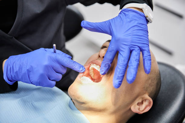Best Emergency Gum Treatment in Toluca, IL
